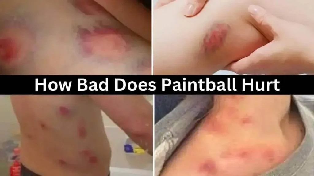How bad does Paintball hurt